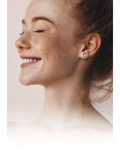 Latisse 3ML - 4-Week Supply